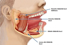 Kulak Altı Tükürük Bezi Şişmesi Belirtileri ve Tedavisi Kulak Altı Tükürük Bezi Şişmesi Belirtileri ve Tedavisi